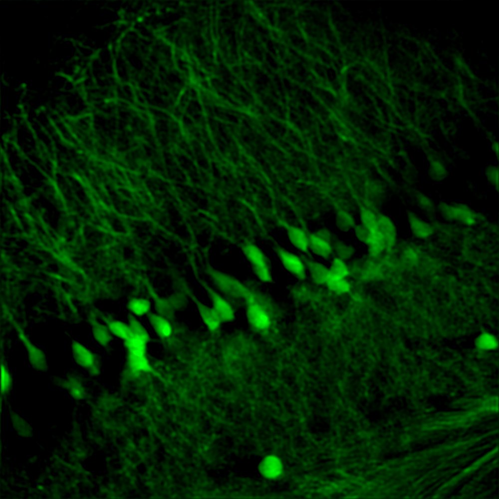 Mouse nerve, SIMSCOP Pseries, 20X objective lens