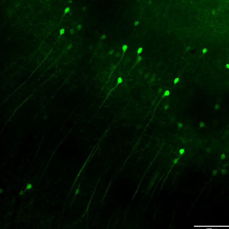 BPAE cells1-100X-SpinDisk-405&488&525